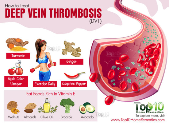deep-vein-thrombosis